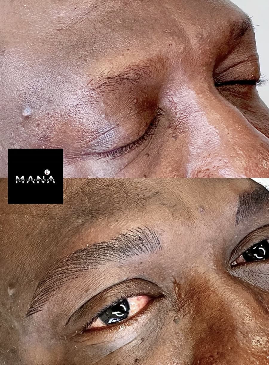 Men's Eyebrow Microblading Transformation A dramatic men's eyebrow microblading transformation reshaping uneven brows into full, natural hair-strokes, by Mana Semipermanent in Jesmond, Newcastle upon Tyne.